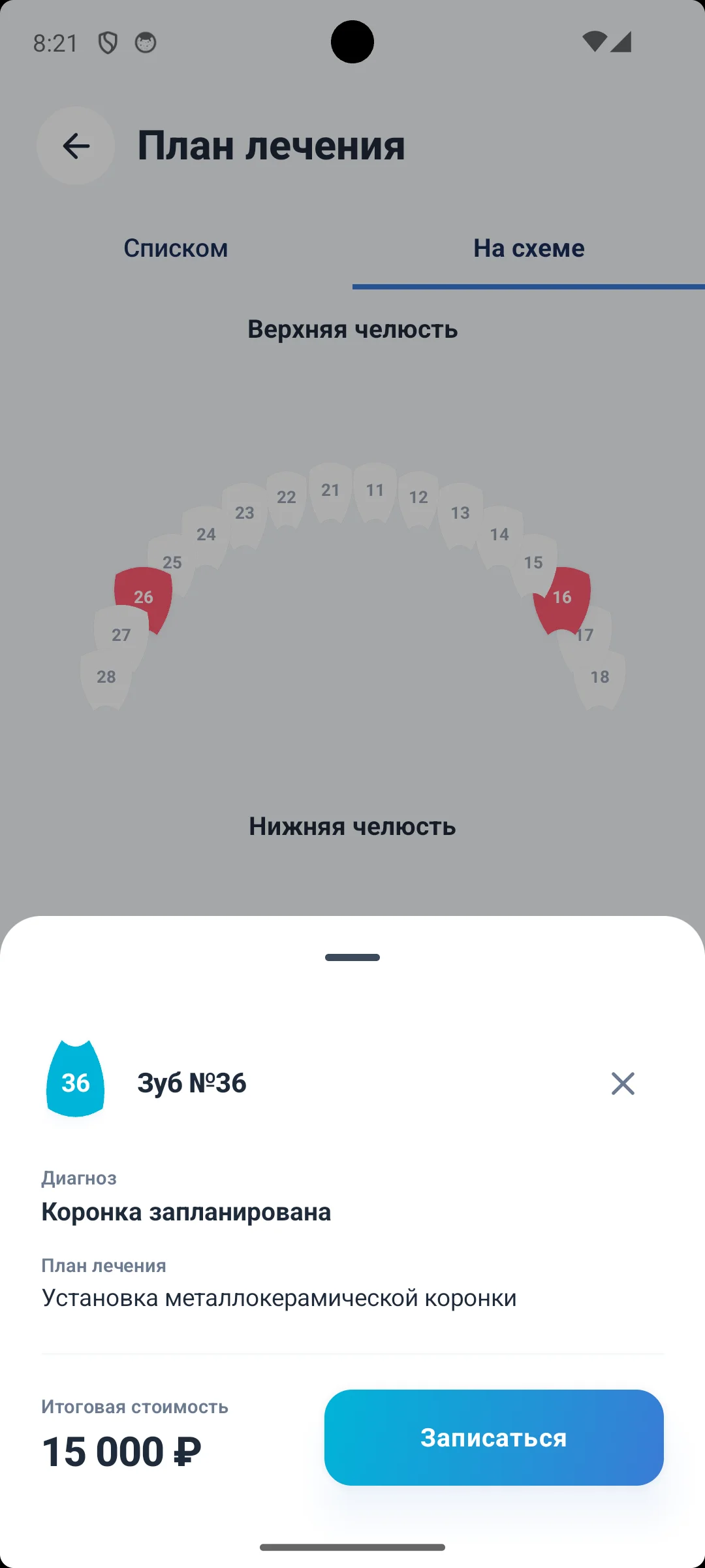 Зубная карта