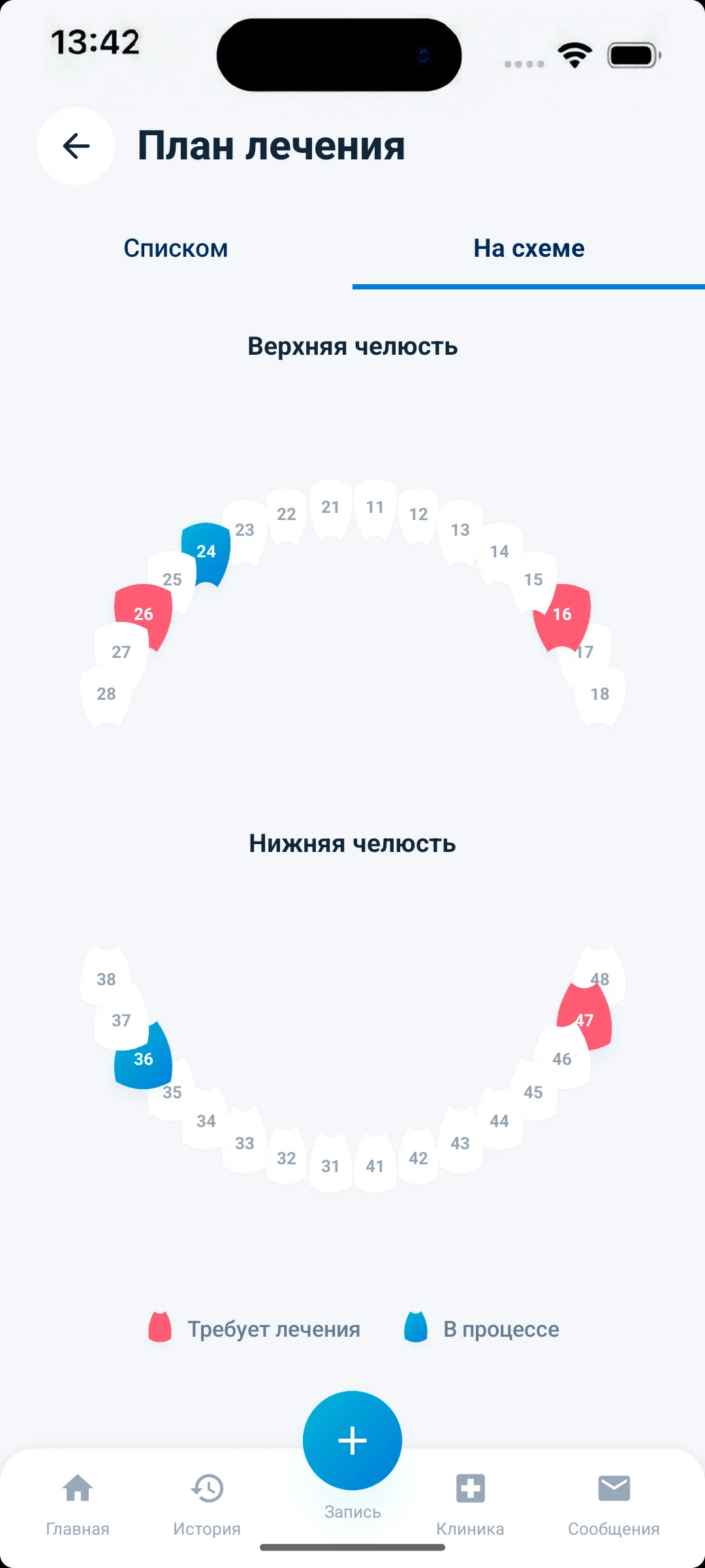 iOS — план лечения